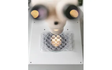 Immunothérapie combiner les données pour mieux prédire l’efficacité