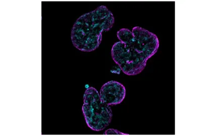 Quand le nombre de chromosomes déraille un mécanisme inédit pour protéger l’intégrité du génome