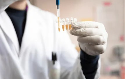 Cancers de l’ovaire et du pancréas : les premiers patients traités dans l'essai clinique prometteur de l'Institut Curie et de sa spin-off PEP-Therapy