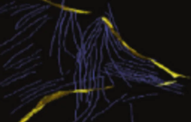 Biologie des tumeurs et immunologie