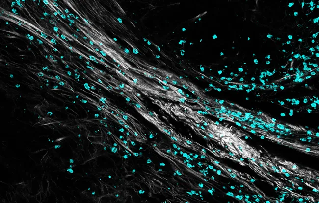 Matrice extracellulaire et infiltration immunitaire : une nouvelle étude de l’Institut Curie fait le lien